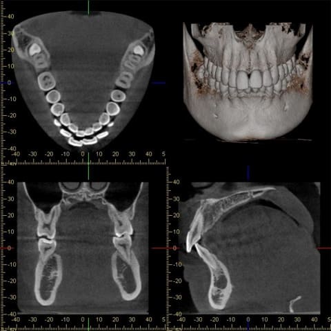 ハートリーフ歯科クリニック東大島　歯科用CT装置